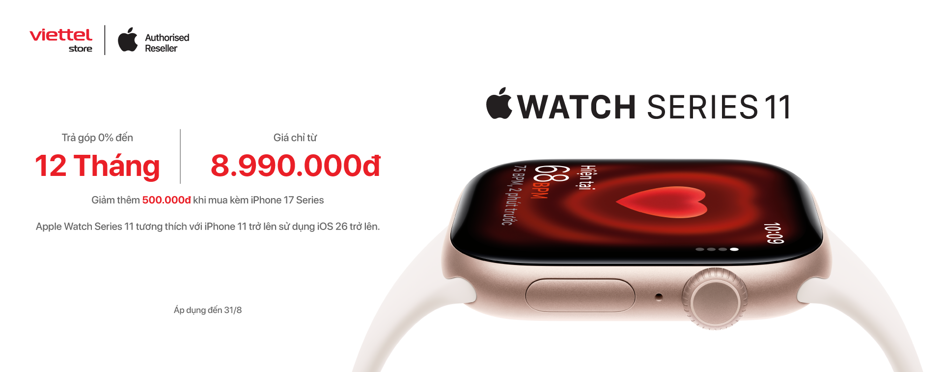 Apple Watch Series 11