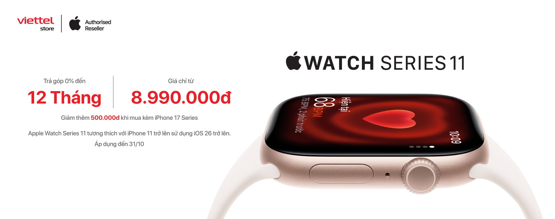 Apple Watch 11